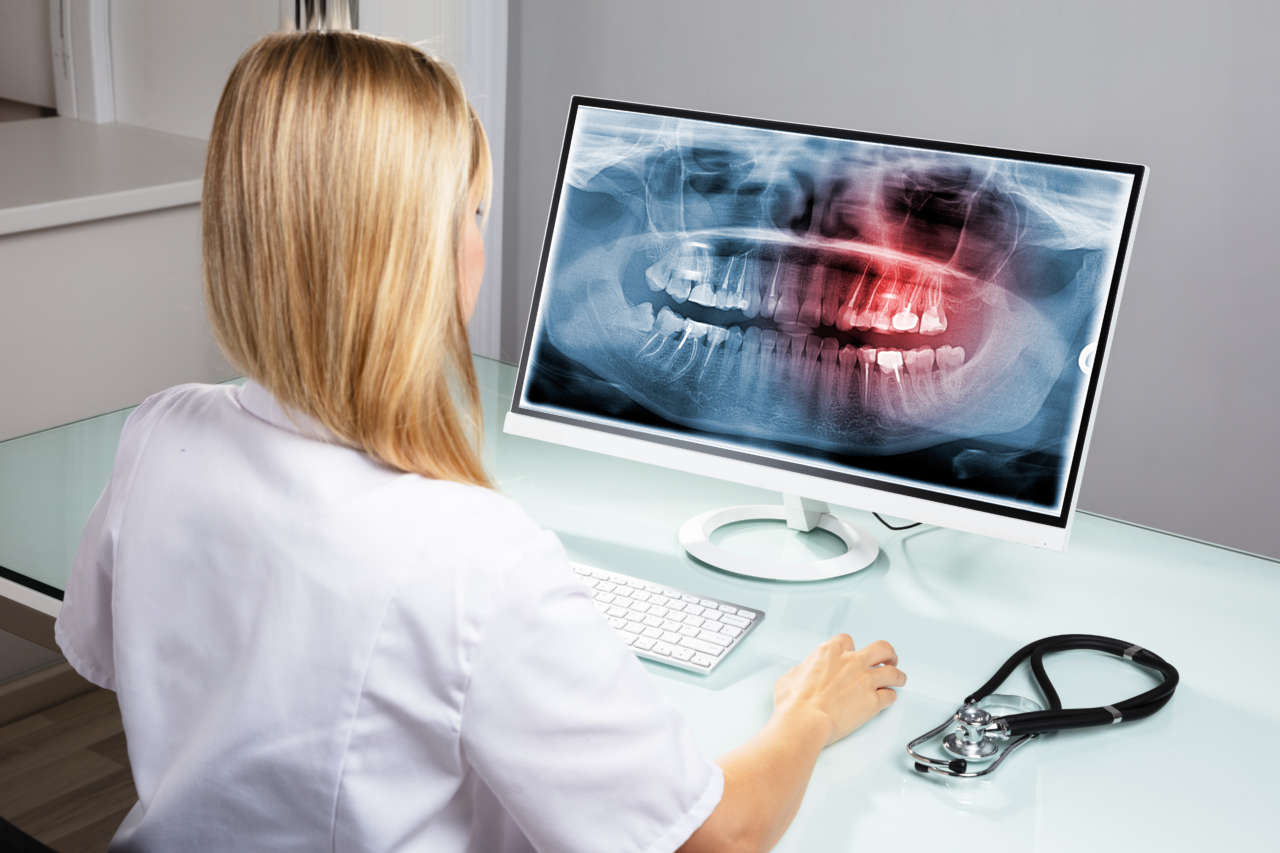 ODONTOIATRI – Detenzione di apparecchiature radiologiche presso lo studio odontoiatrico con utilizzo in regime di radiodiagnostica complementare.